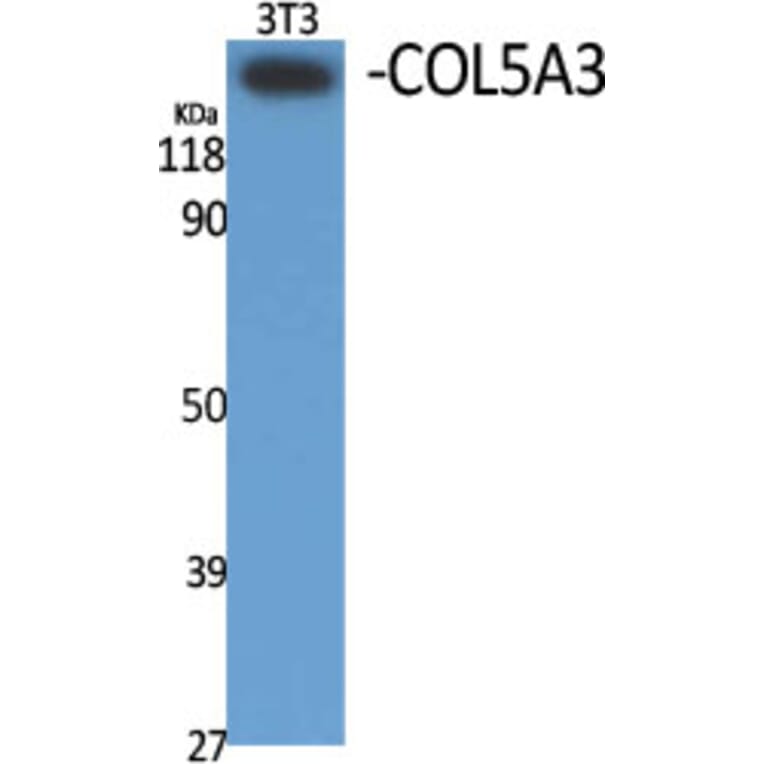 Western Blot - Anti-Collagen V alpha3 Antibody (C12203) - Antibodies.com