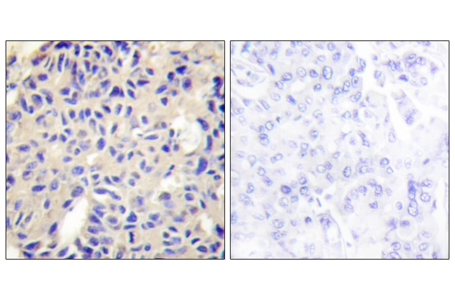 Immunohistochemistry - Anti-Collagen V alpha2 Antibody (C12202) - Antibodies.com