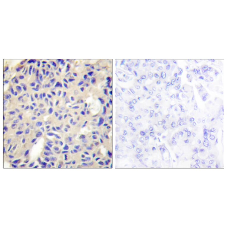 Immunohistochemistry - Anti-Collagen V alpha2 Antibody (C12202) - Antibodies.com