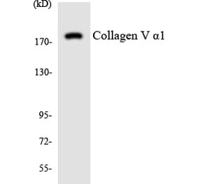 Western Blot - Anti-Collagen V alpha1 Antibody (R12-2642) - Antibodies.com