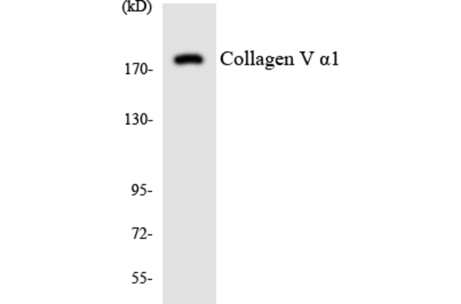 Western Blot - Anti-Collagen V alpha1 Antibody (R12-2642) - Antibodies.com