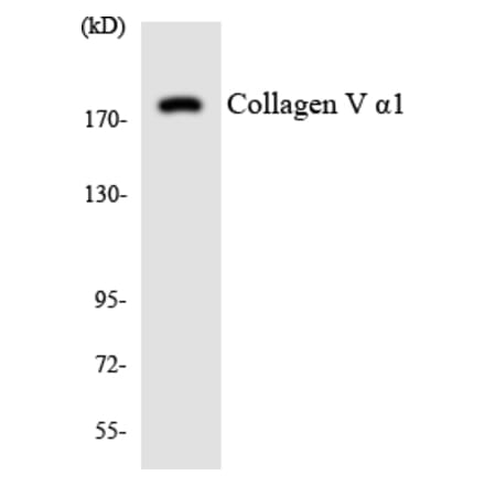 Western Blot - Anti-Collagen V alpha1 Antibody (R12-2642) - Antibodies.com