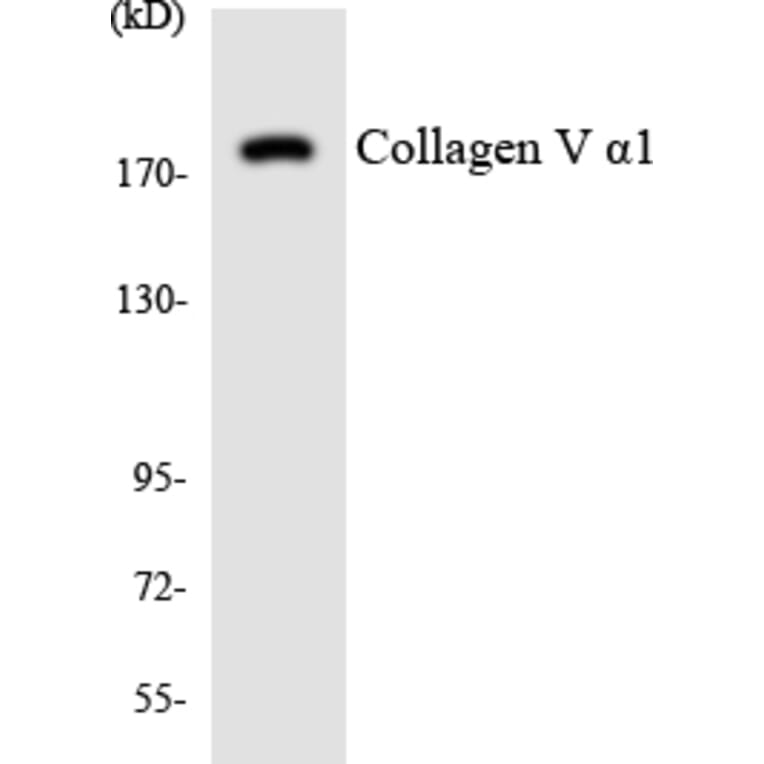 Western Blot - Anti-Collagen V alpha1 Antibody (R12-2642) - Antibodies.com