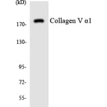 Western Blot - Anti-Collagen V alpha1 Antibody (R12-2642) - Antibodies.com