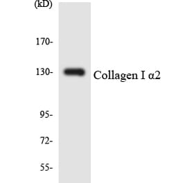 Western Blot - Anti-Collagen I alpha2 Antibody (R12-2641) - Antibodies.com