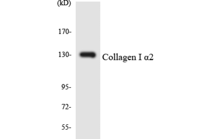 Western Blot - Anti-Collagen I alpha2 Antibody (R12-2641) - Antibodies.com