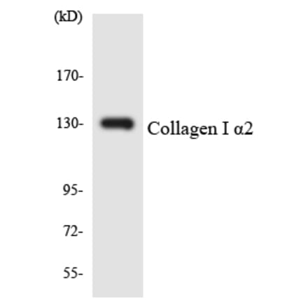 Western Blot - Anti-Collagen I alpha2 Antibody (R12-2641) - Antibodies.com