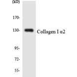 Western Blot - Anti-Collagen I alpha2 Antibody (R12-2641) - Antibodies.com