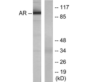 Western Blot - Anti-Androgen Receptor Antibody (B7009) - Antibodies.com