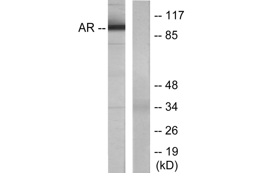 Western Blot - Anti-Androgen Receptor Antibody (B7009) - Antibodies.com