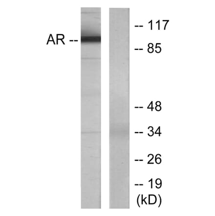 Western Blot - Anti-Androgen Receptor Antibody (B7009) - Antibodies.com
