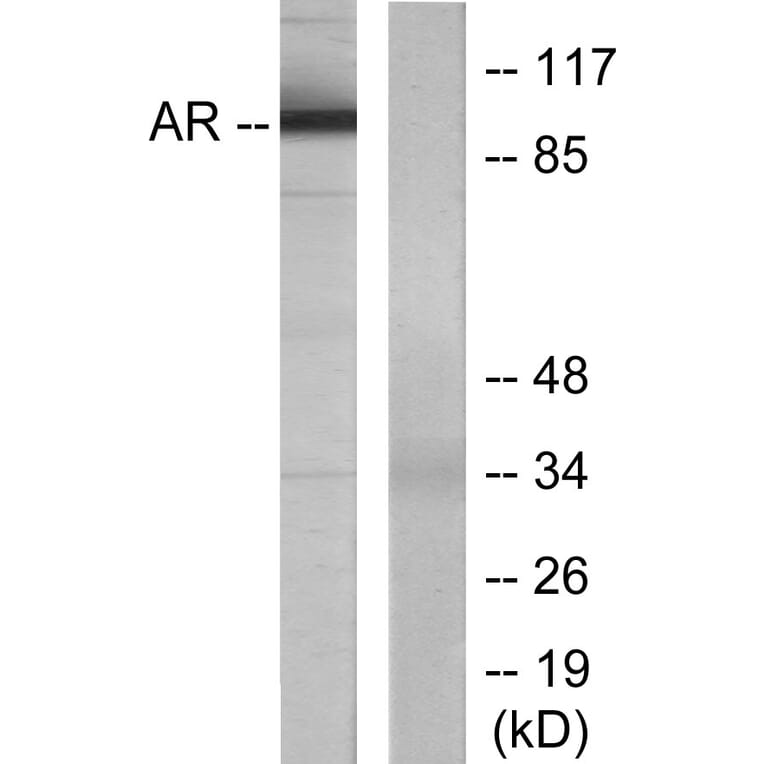Western Blot - Anti-Androgen Receptor Antibody (B7009) - Antibodies.com