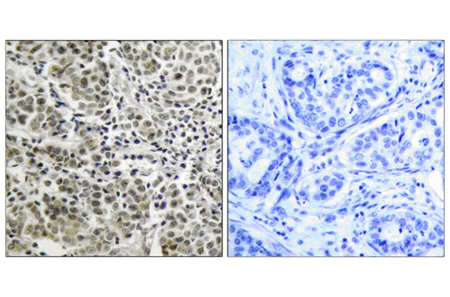 Immunohistochemistry - Anti-Androgen Receptor Antibody (B7009) - Antibodies.com