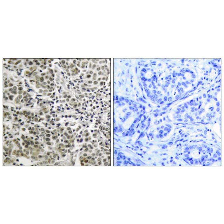 Immunohistochemistry - Anti-Androgen Receptor Antibody (B7009) - Antibodies.com
