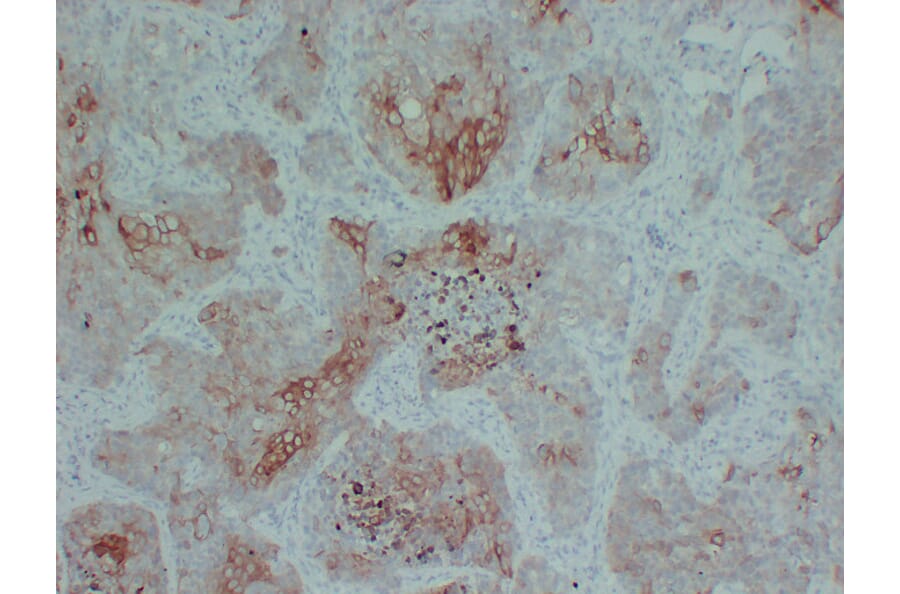 Immunohistochemistry - Anti-Cytokeratin 5 + 6 Antibody (V0055) - Antibodies.com