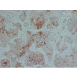 Immunohistochemistry - Anti-Cytokeratin 5 + 6 Antibody (V0055) - Antibodies.com