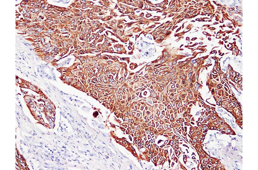 Immunohistochemistry - Anti-Cytokeratin 5 + 6 Antibody (V0055) - Antibodies.com