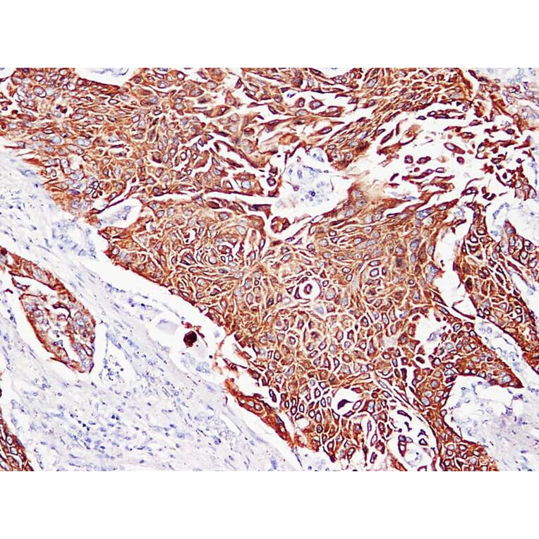 Immunohistochemistry - Anti-Cytokeratin 5 + 6 Antibody (V0055) - Antibodies.com