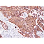 Immunohistochemistry - Anti-Cytokeratin 5 + 6 Antibody (V0055) - Antibodies.com