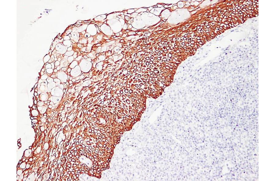 Immunohistochemistry - Anti-Cytokeratin 5 + 6 Antibody (V0055) - Antibodies.com