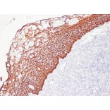Immunohistochemistry - Anti-Cytokeratin 5 + 6 Antibody (V0055) - Antibodies.com
