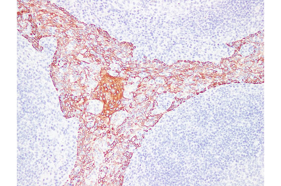 Immunohistochemistry - Anti-Cytokeratin 5 + 6 Antibody (V0055) - Antibodies.com