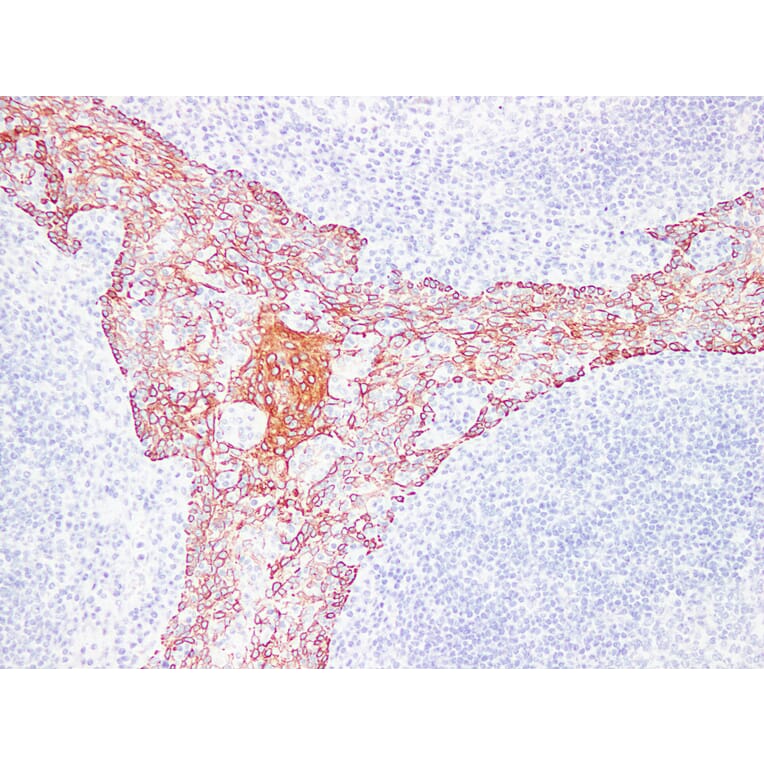 Immunohistochemistry - Anti-Cytokeratin 5 + 6 Antibody (V0055) - Antibodies.com