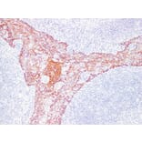 Immunohistochemistry - Anti-Cytokeratin 5 + 6 Antibody (V0055) - Antibodies.com