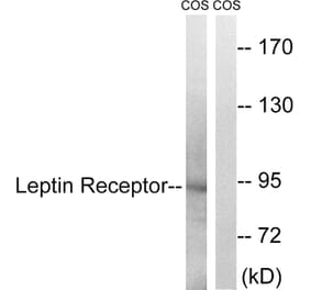 Western Blot - Anti-Leptin Receptor Antibody (B8265) - Antibodies.com