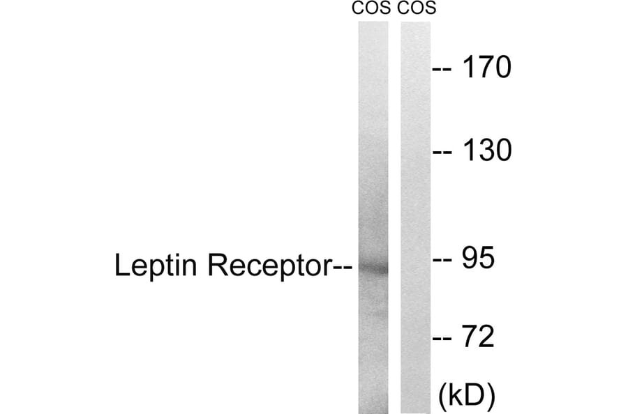 Western Blot - Anti-Leptin Receptor Antibody (B8265) - Antibodies.com
