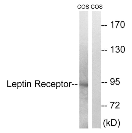 Western Blot - Anti-Leptin Receptor Antibody (B8265) - Antibodies.com