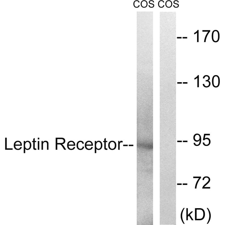 Western Blot - Anti-Leptin Receptor Antibody (B8265) - Antibodies.com