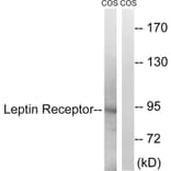 Western Blot - Anti-Leptin Receptor Antibody (B8265) - Antibodies.com