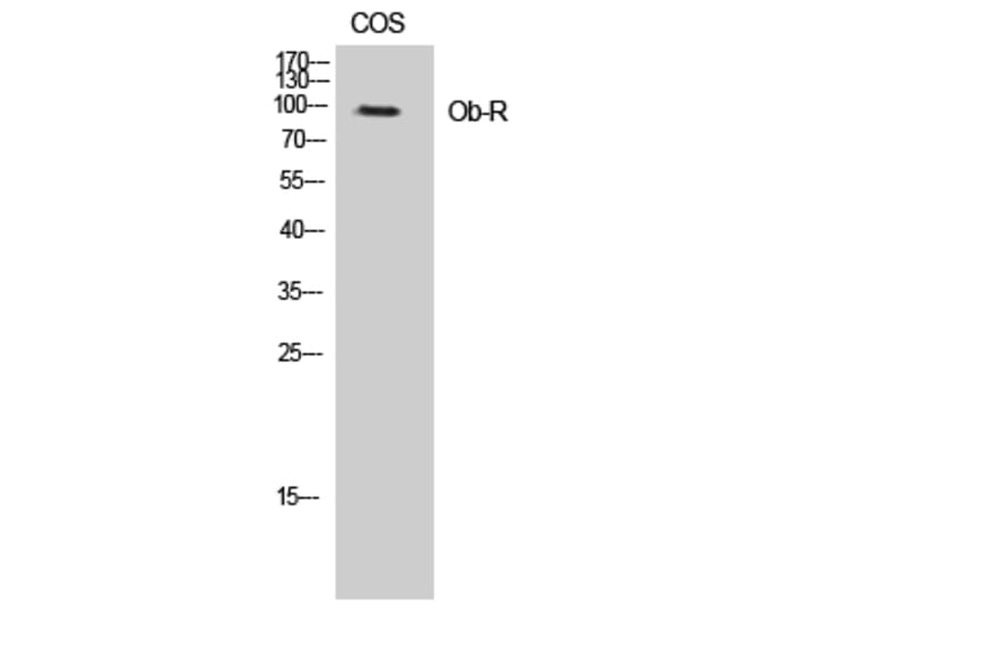 Western Blot - Anti-Leptin Receptor Antibody (B8265) - Antibodies.com