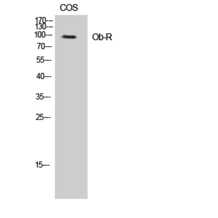 Western Blot - Anti-Leptin Receptor Antibody (B8265) - Antibodies.com