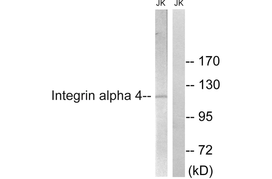 Western Blot - Anti-Integrin alpha4 Antibody (B1071) - Antibodies.com