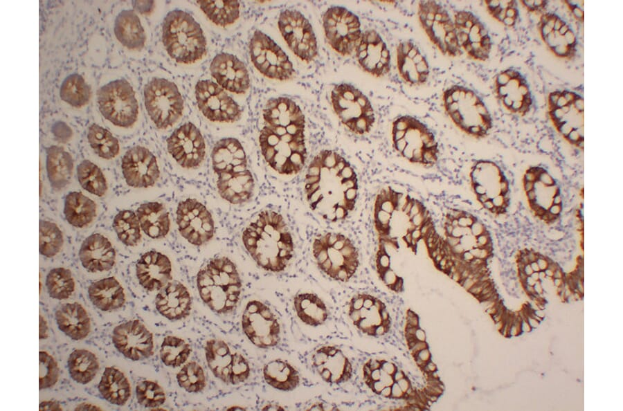 Immunohistochemistry - Anti-Cytokeratin 19 Antibody (V0051) - Antibodies.com