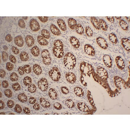 Immunohistochemistry - Anti-Cytokeratin 19 Antibody (V0051) - Antibodies.com