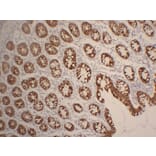 Immunohistochemistry - Anti-Cytokeratin 19 Antibody (V0051) - Antibodies.com