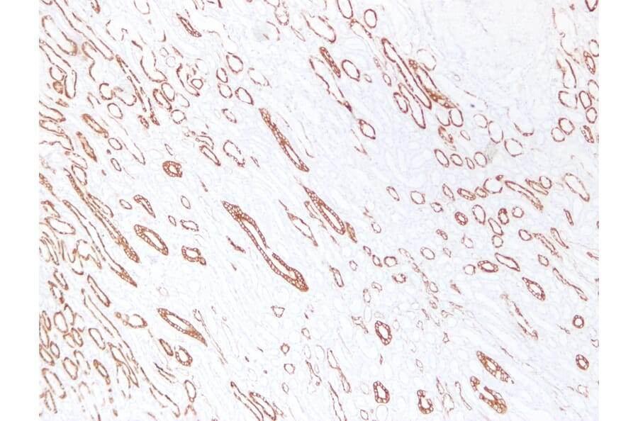Immunohistochemistry - Anti-Cytokeratin 19 Antibody (V0051) - Antibodies.com
