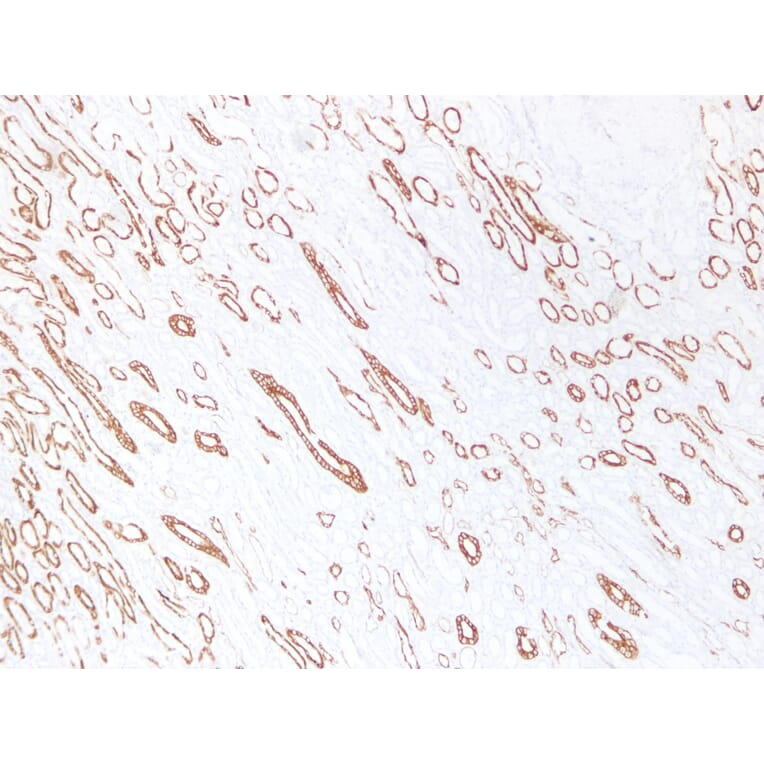 Immunohistochemistry - Anti-Cytokeratin 19 Antibody (V0051) - Antibodies.com