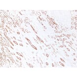 Immunohistochemistry - Anti-Cytokeratin 19 Antibody (V0051) - Antibodies.com