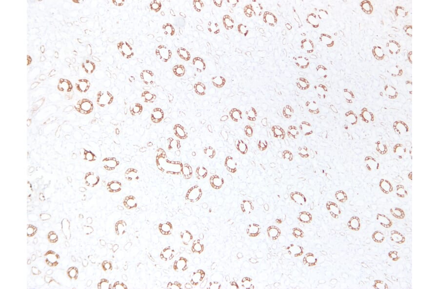 Immunohistochemistry - Anti-Cytokeratin 19 Antibody (V0051) - Antibodies.com