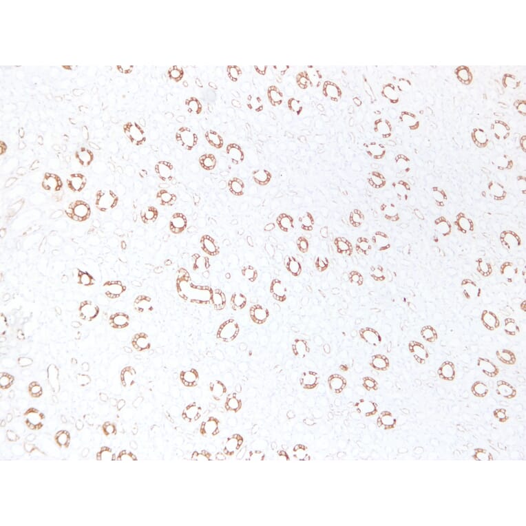 Immunohistochemistry - Anti-Cytokeratin 19 Antibody (V0051) - Antibodies.com