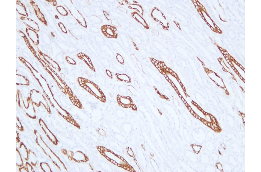 Immunohistochemistry - Anti-Cytokeratin 19 Antibody (V0051) - Antibodies.com