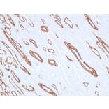 Immunohistochemistry - Anti-Cytokeratin 19 Antibody (V0051) - Antibodies.com