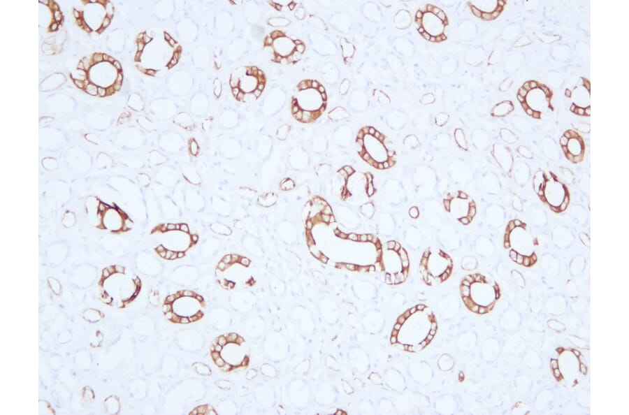 Immunohistochemistry - Anti-Cytokeratin 19 Antibody (V0051) - Antibodies.com