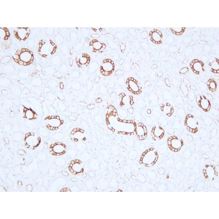 Immunohistochemistry - Anti-Cytokeratin 19 Antibody (V0051) - Antibodies.com