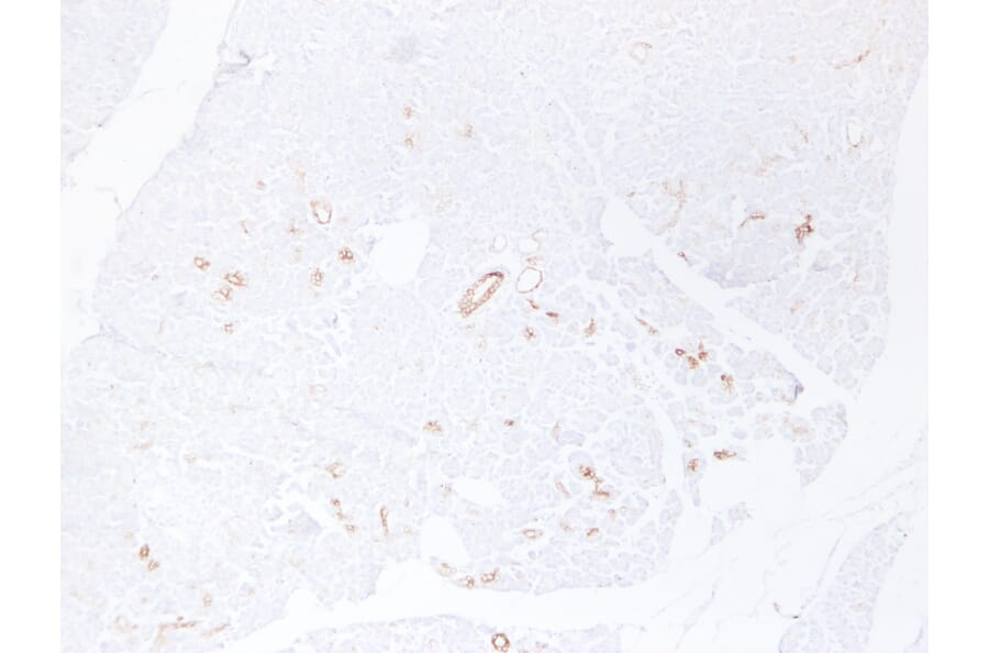 Immunohistochemistry - Anti-Cytokeratin 19 Antibody (V0051) - Antibodies.com
