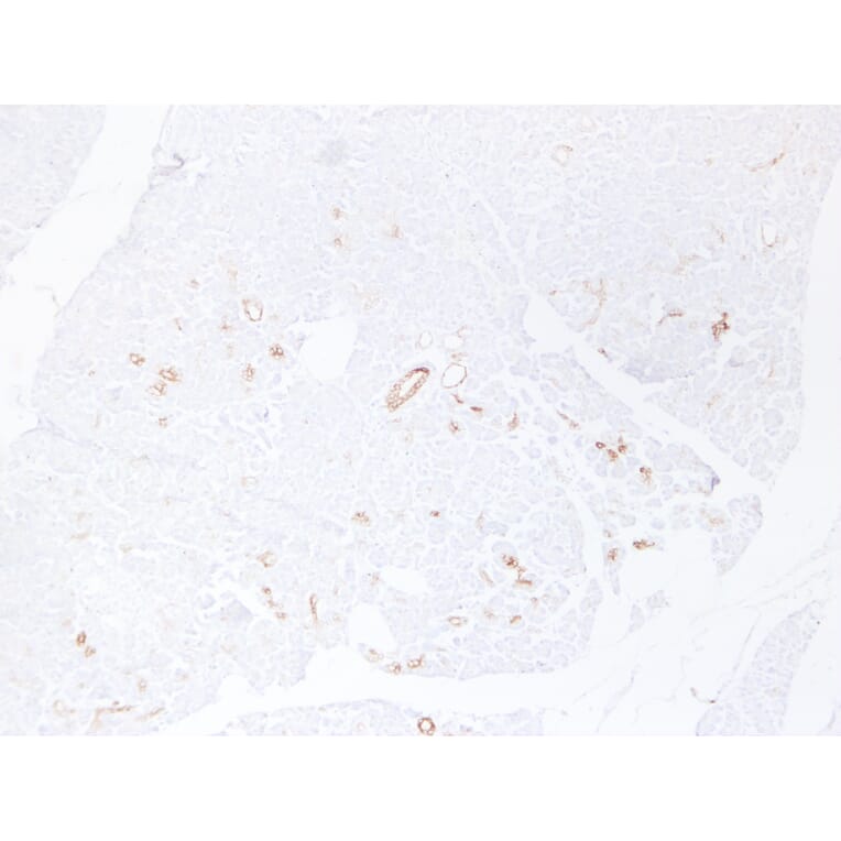 Immunohistochemistry - Anti-Cytokeratin 19 Antibody (V0051) - Antibodies.com